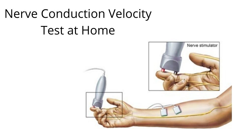 NCV Test: #1 Choice for High-Quality & Reliable NCV Test in Delhi