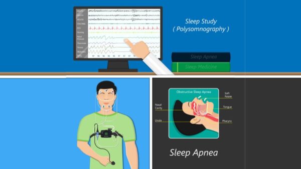 Sleep Study Test at Home: What Can A Sleep Study Diagnose?